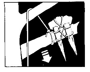arco 0005